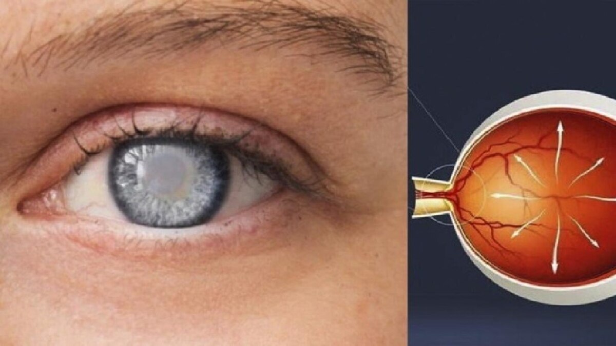 باشگاه خبرنگاران -۵ اشتباه رایج تابستانی که به سلامت چشم آسیب می‌رساند